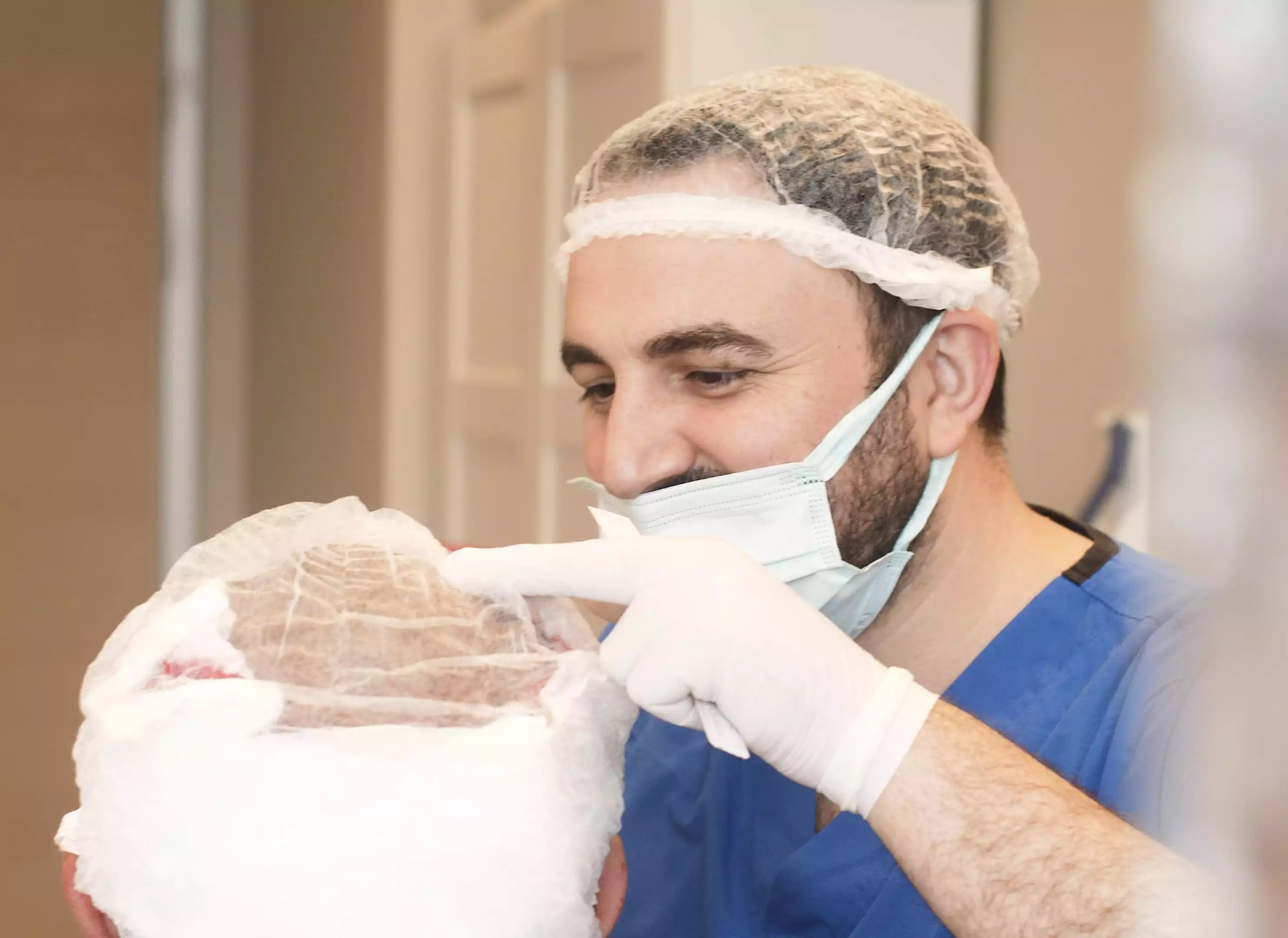What is the Hair Transplant Success Rate?