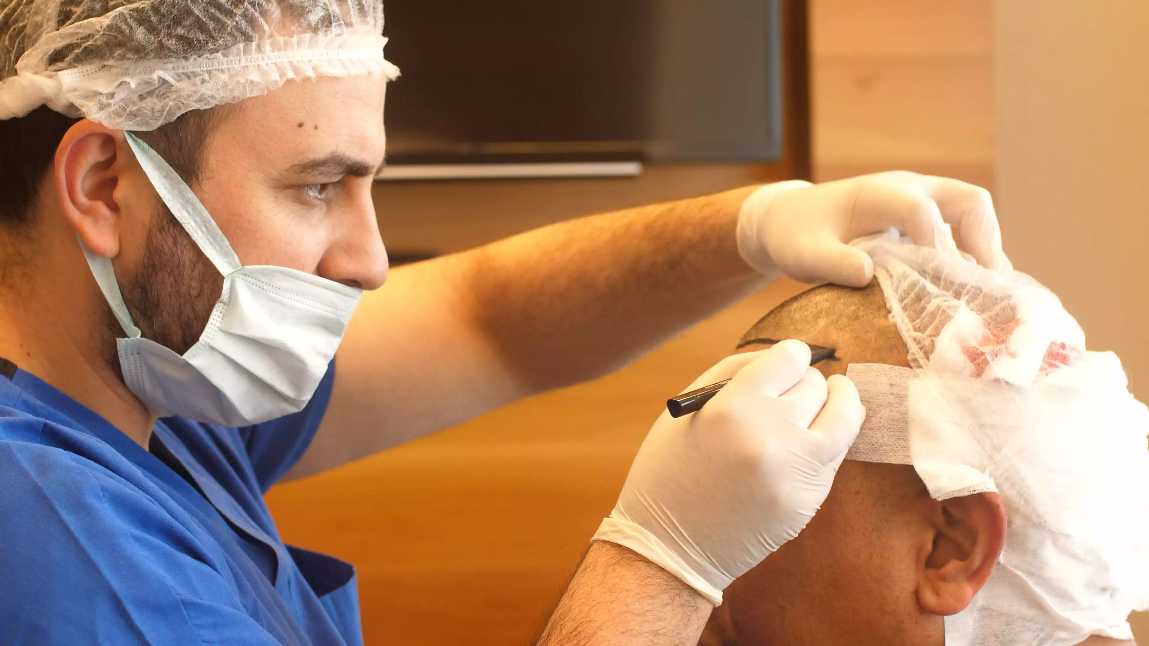 Will There Be Pain After Hair Transplant?