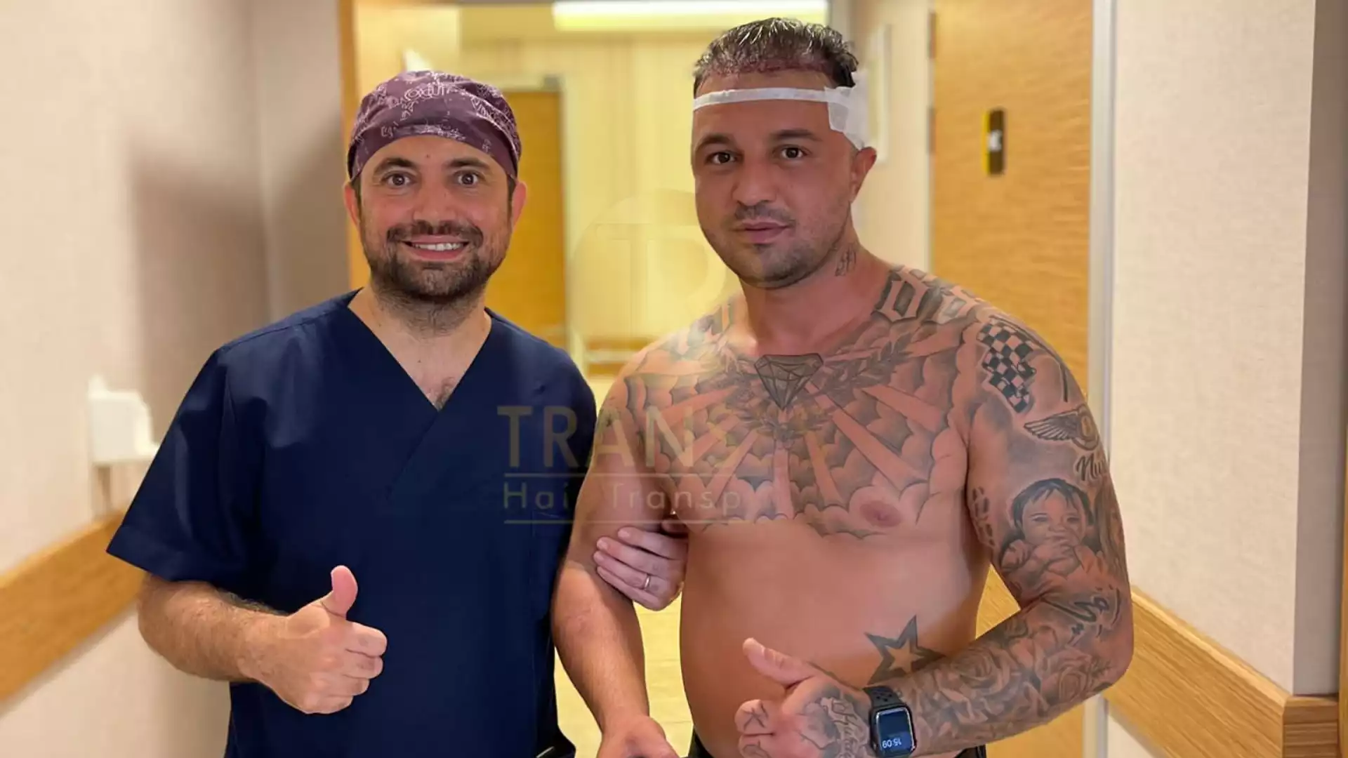 DHI Direct Hair Transplant