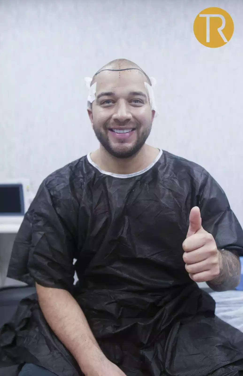 Hybrid Hair Transplant