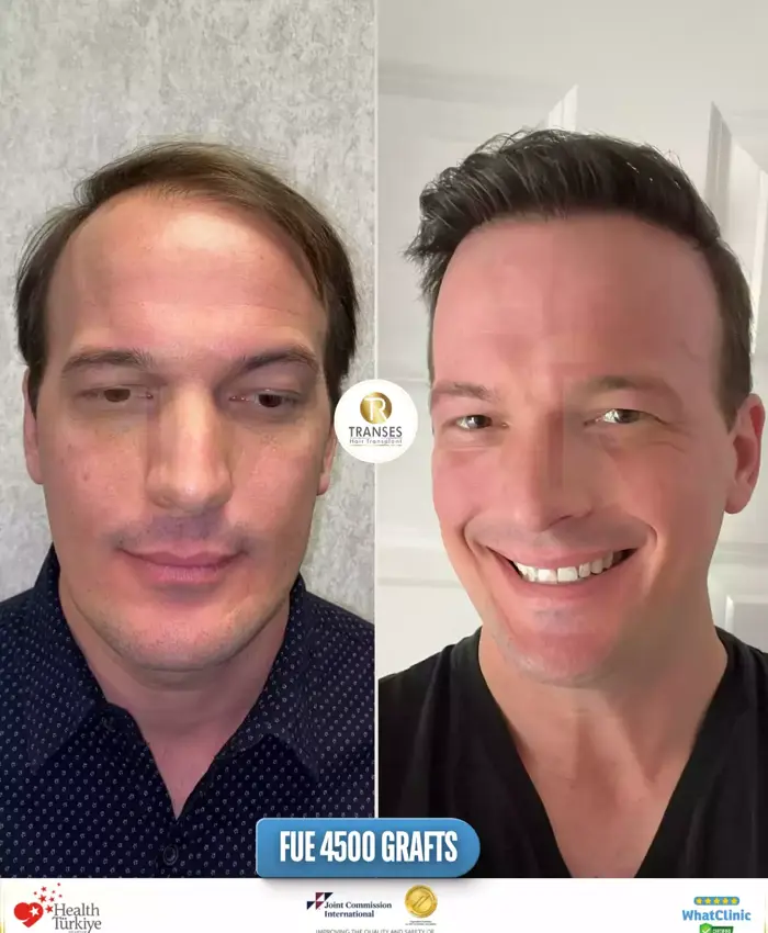 Before & After