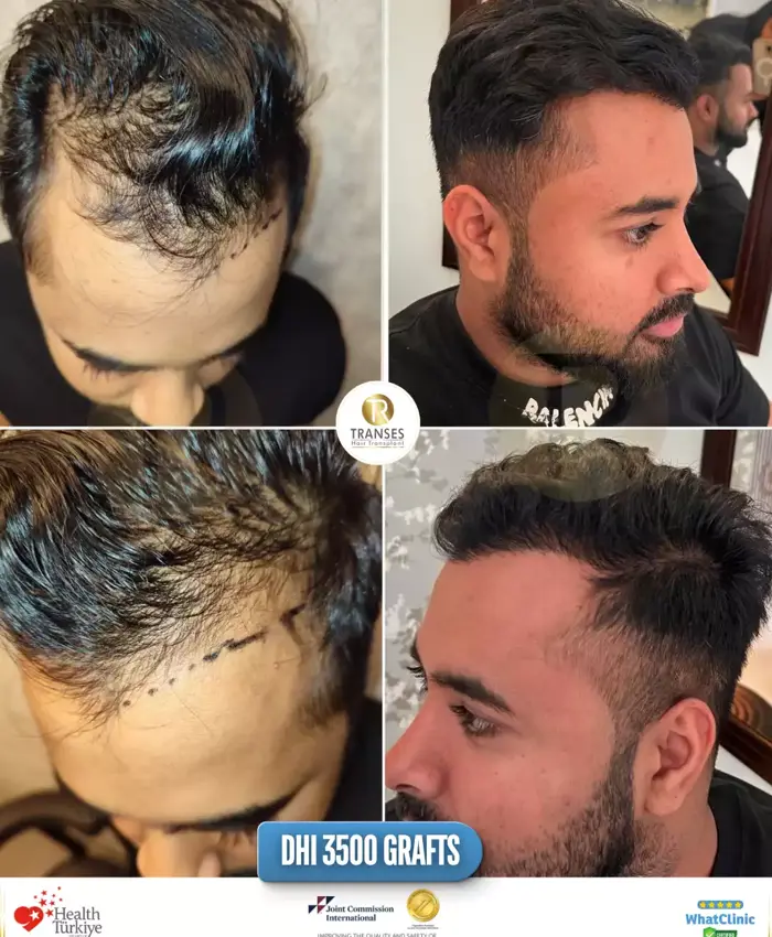 Before & After