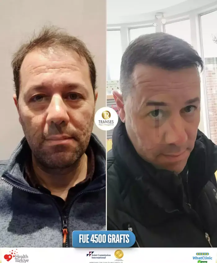 Before & After