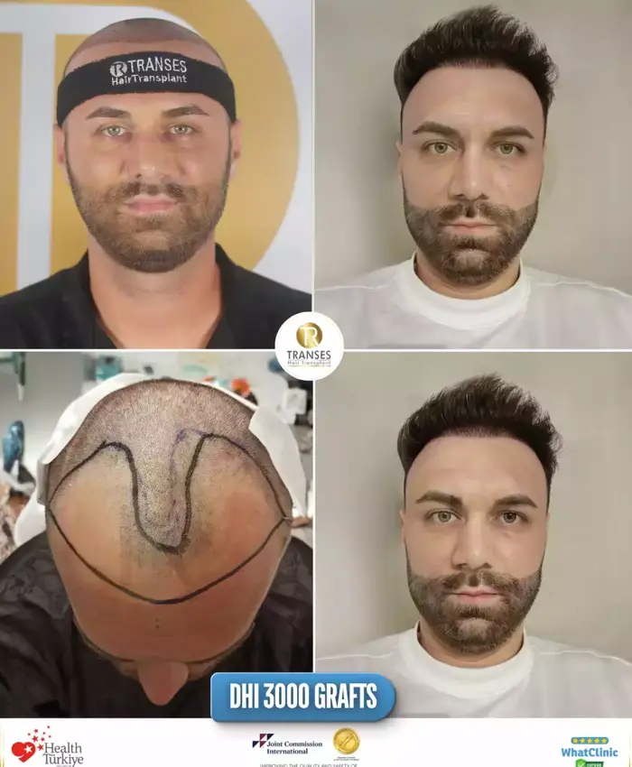 Before & After