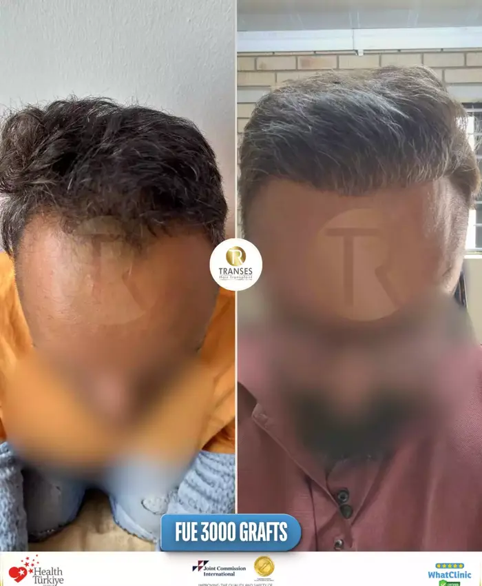 Before & After