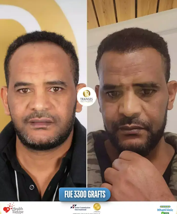 Before & After