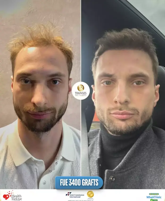 Before & After