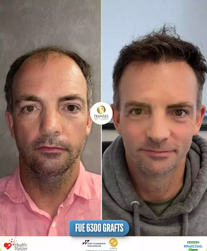 Before & After