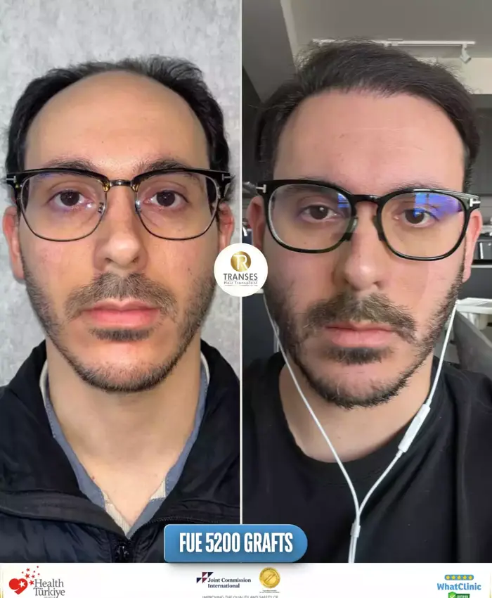 Before & After
