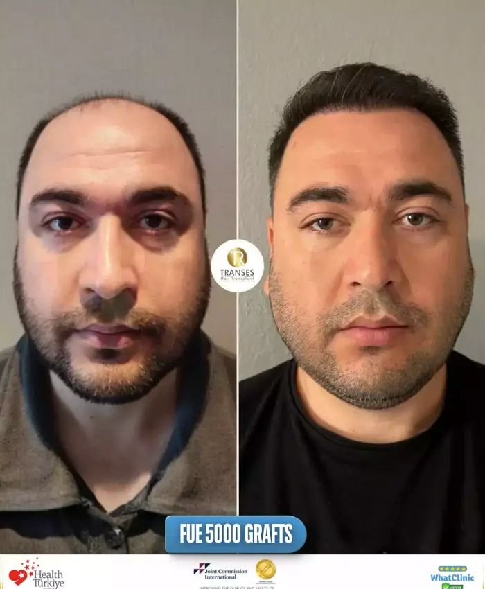 Before & After