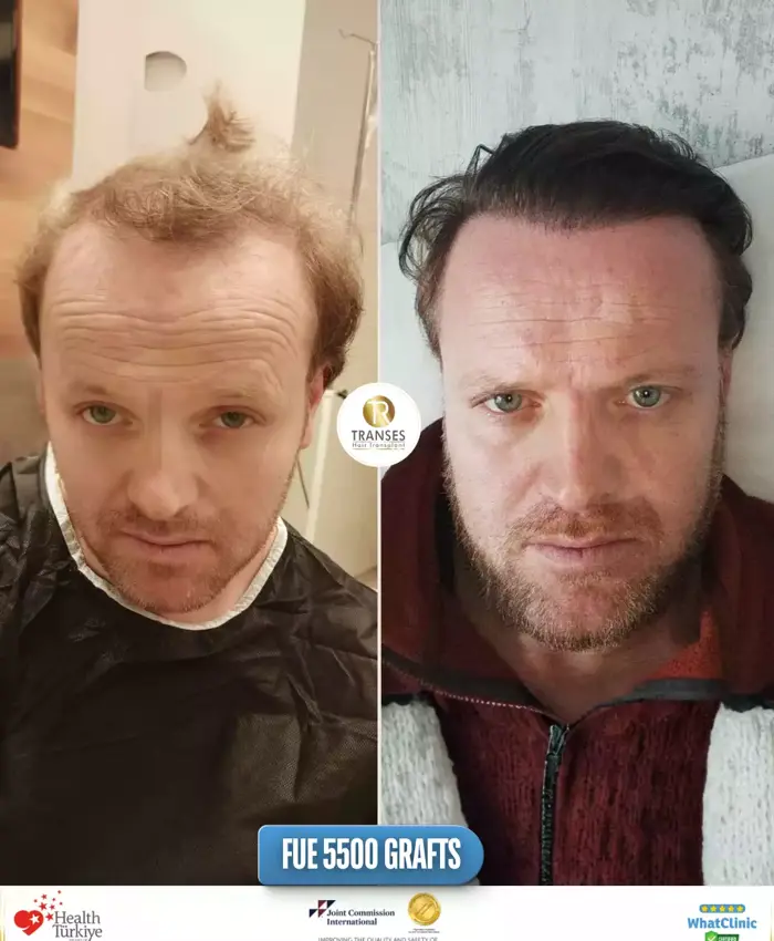Before & After
