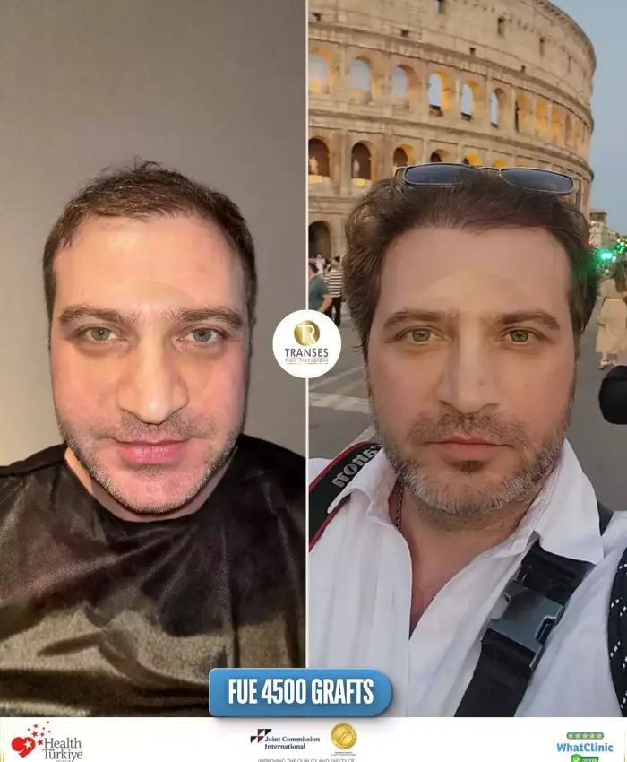 Before & After