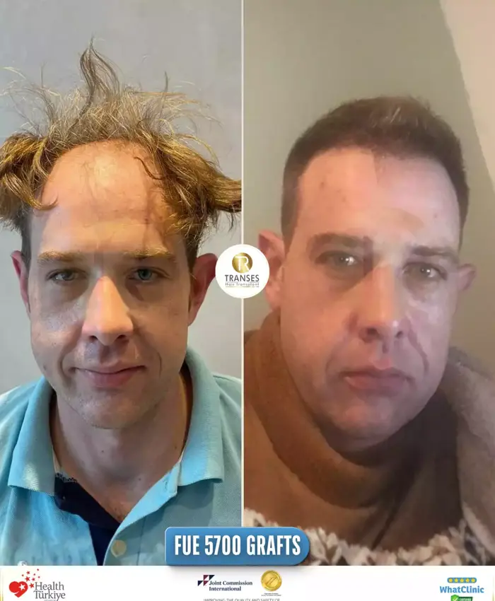 Before & After