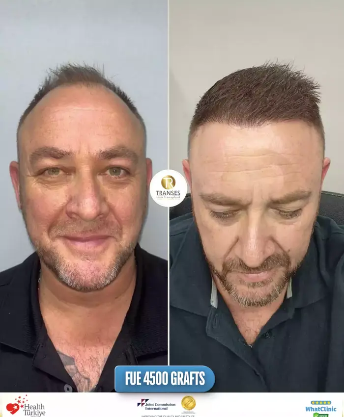 Before & After