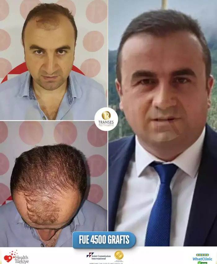 Before & After
