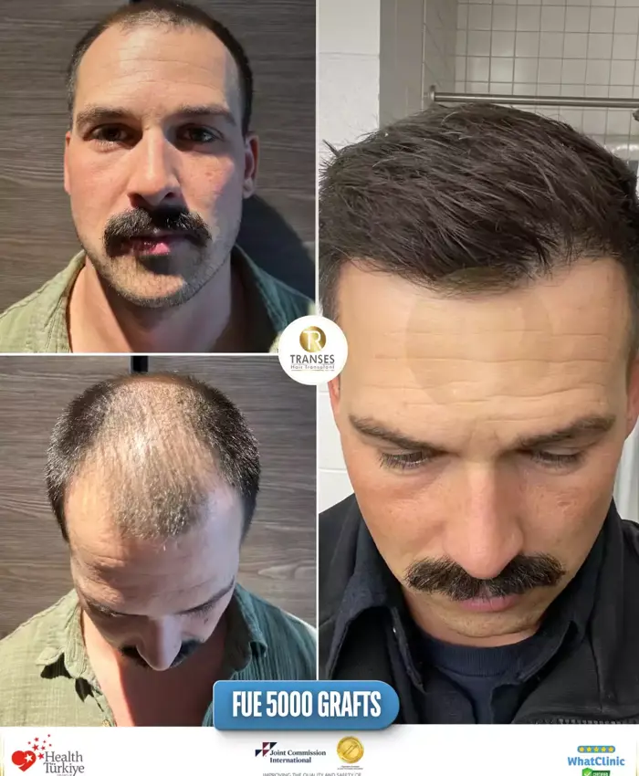 Before & After