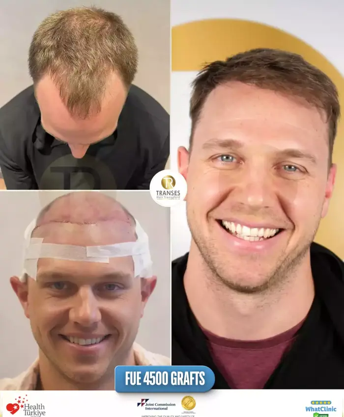 Before & After