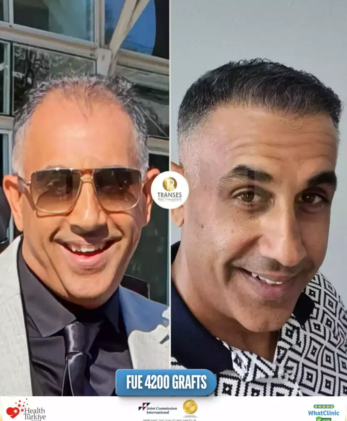 Before & After