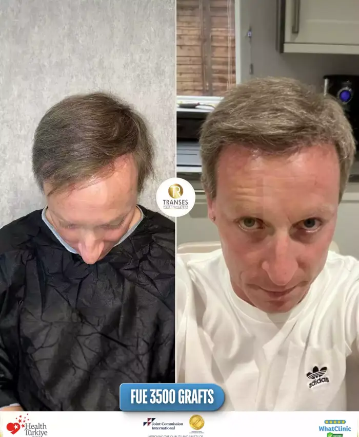 Before & After