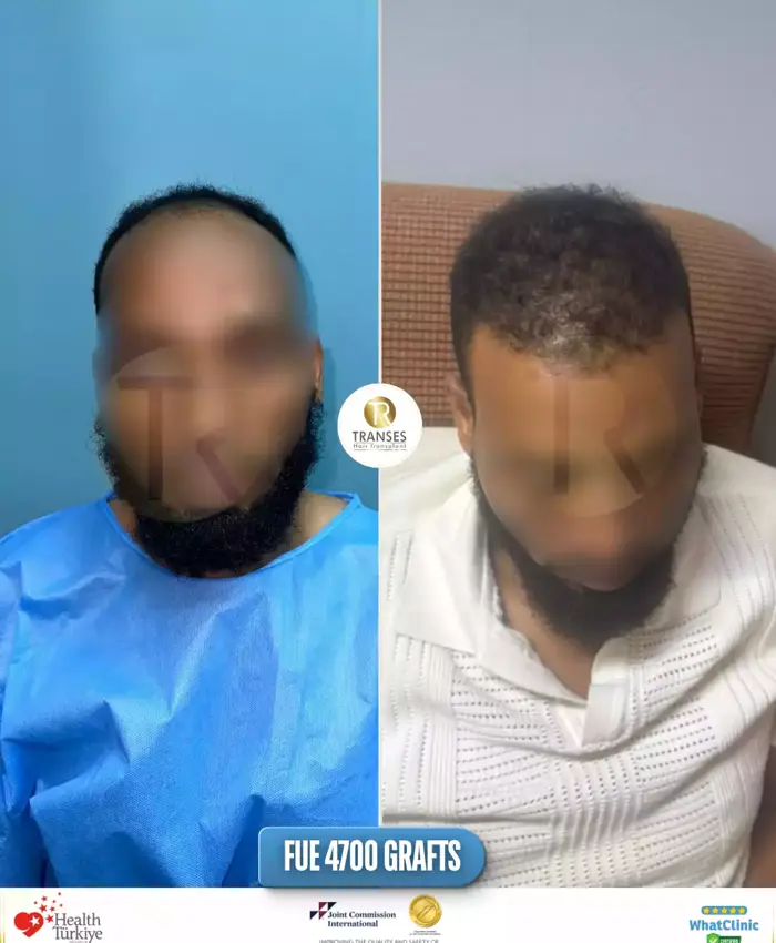 Before & After