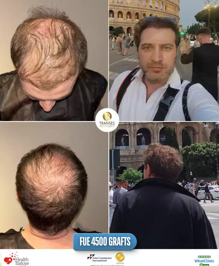 Before & After