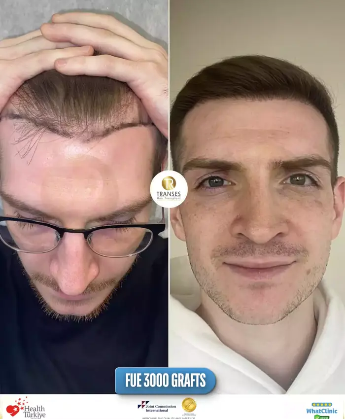 Before & After