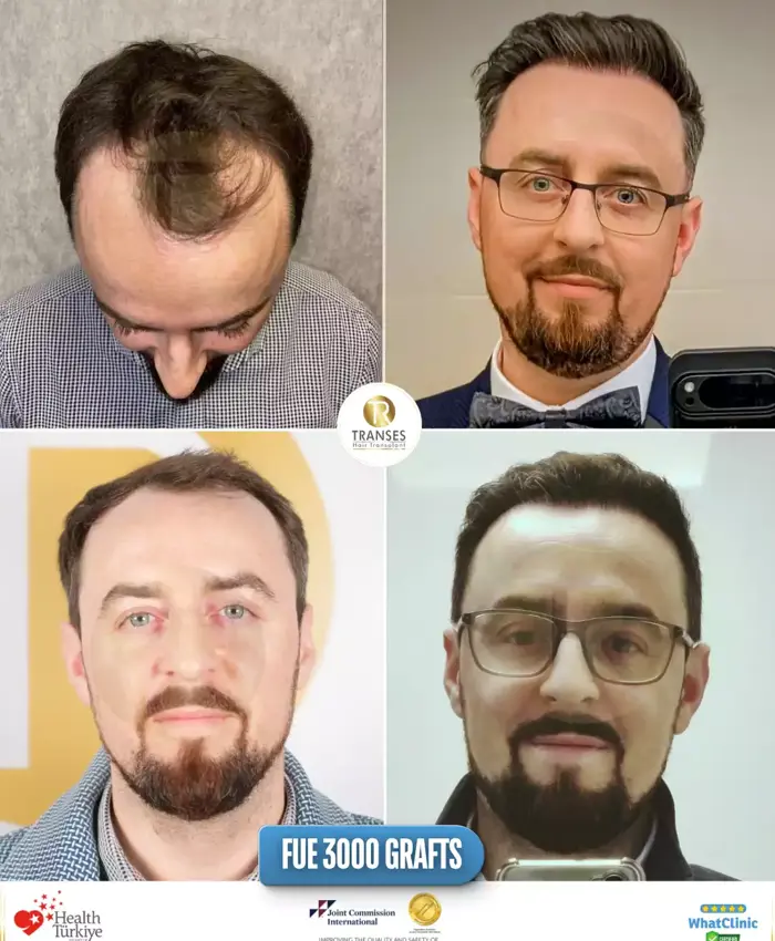 Before & After