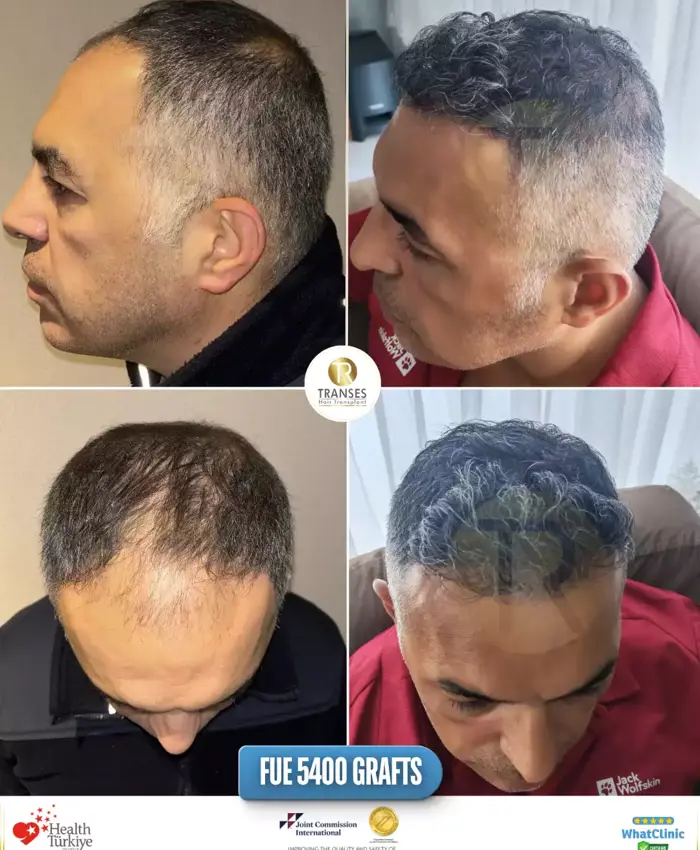 Before & After