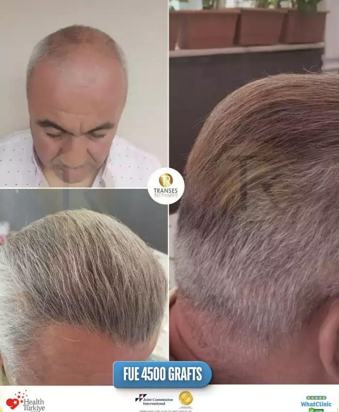 Before & After