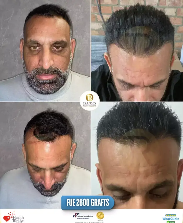 Before & After