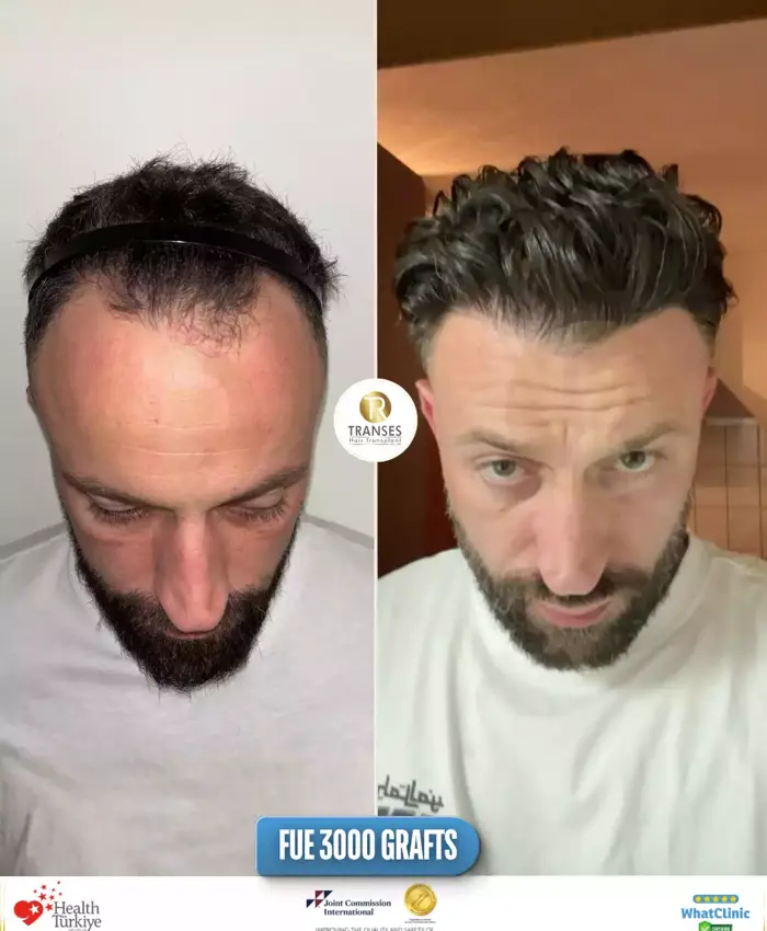 Before & After