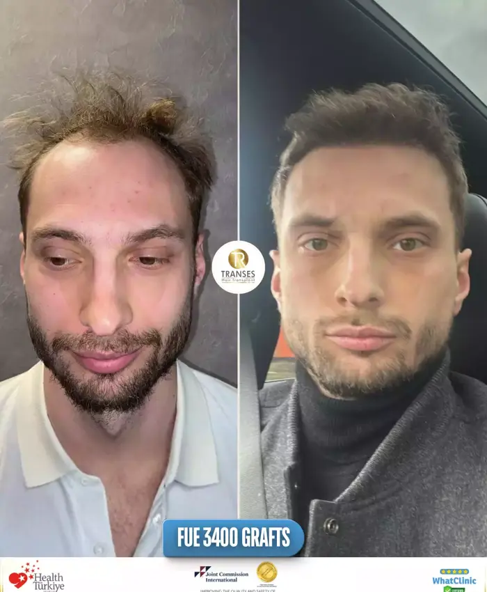 Before & After