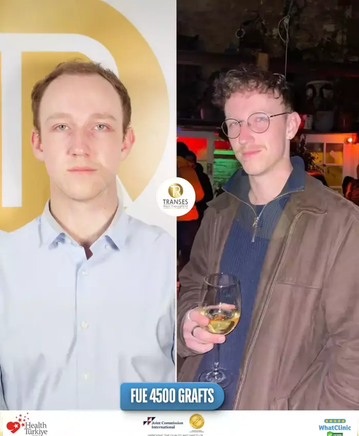 Before & After
