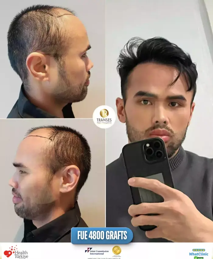 Before & After