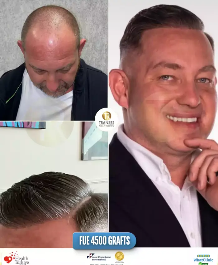Before & After