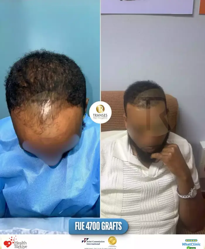 Before & After