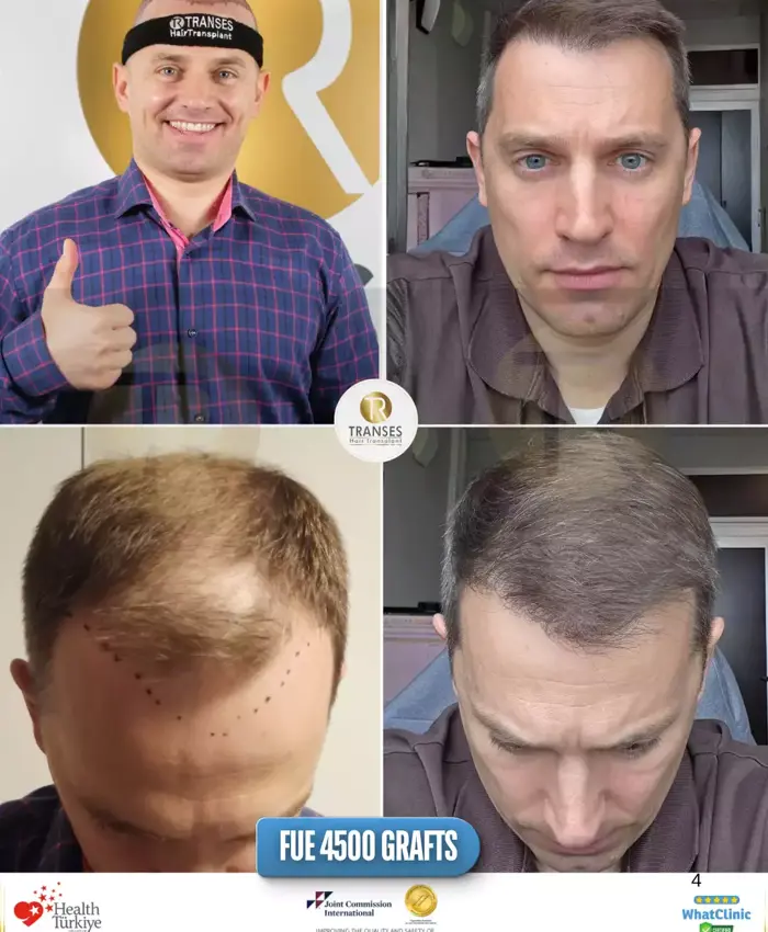 Before & After