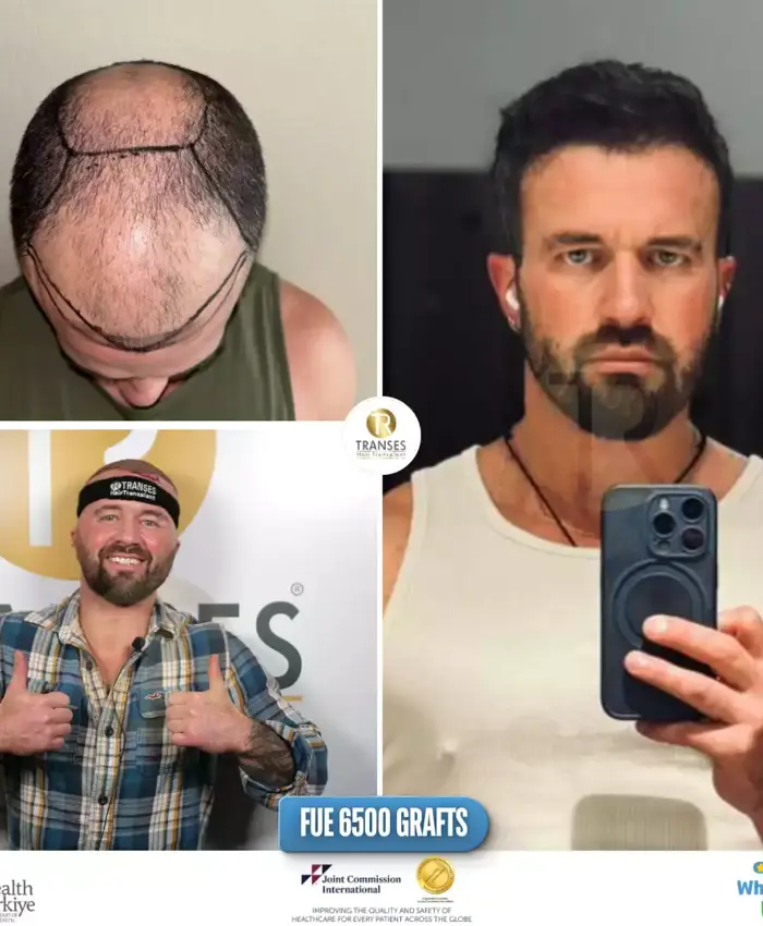 Before & After