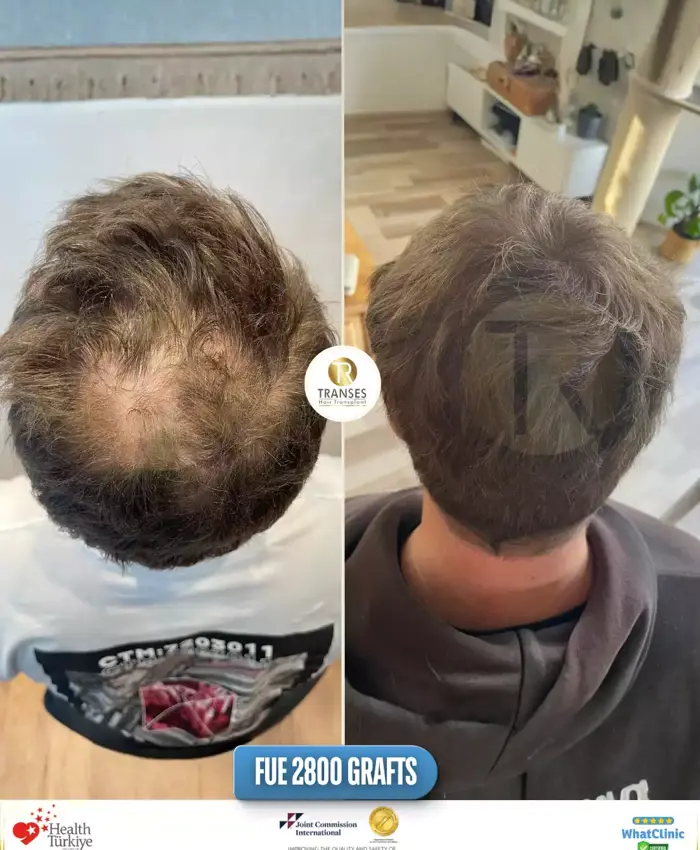 Before & After
