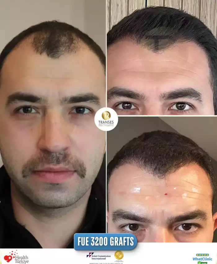 Before & After