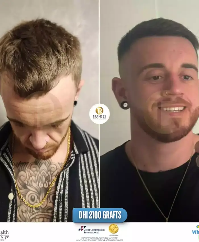 Before & After