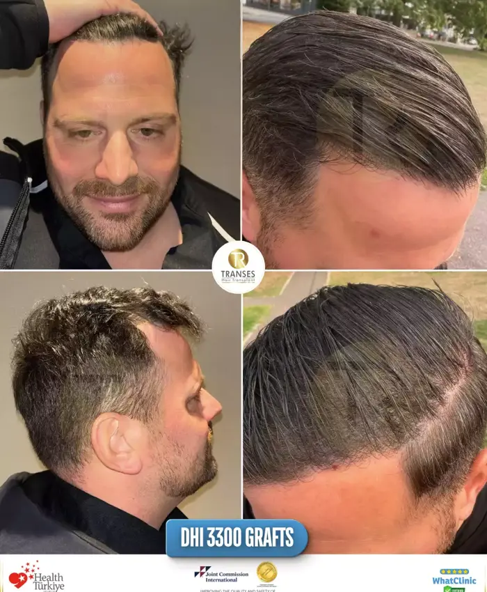 Before & After