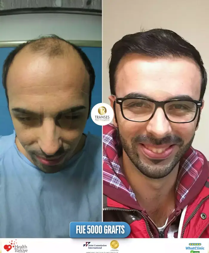 Before & After