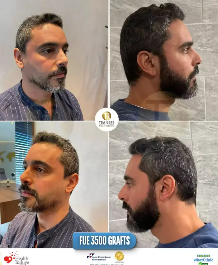 Before & After