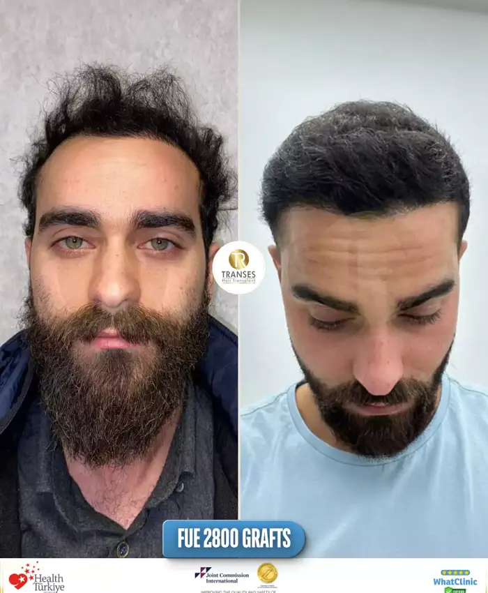 Before & After