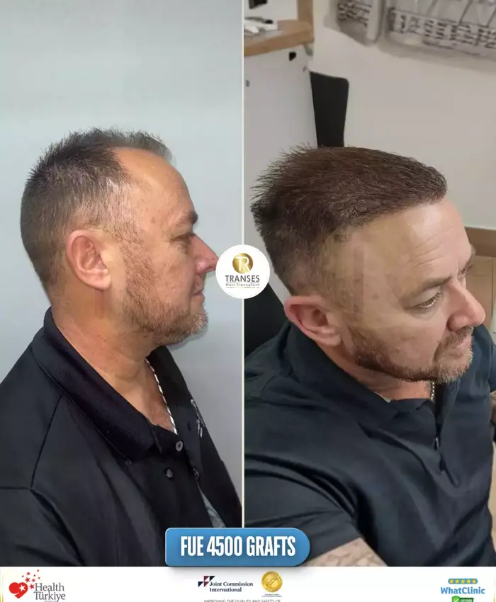 Before & After