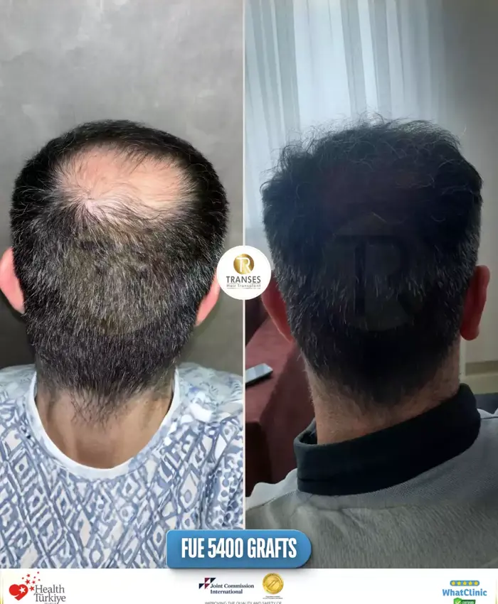 Before & After