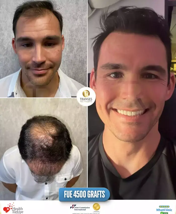 Before & After