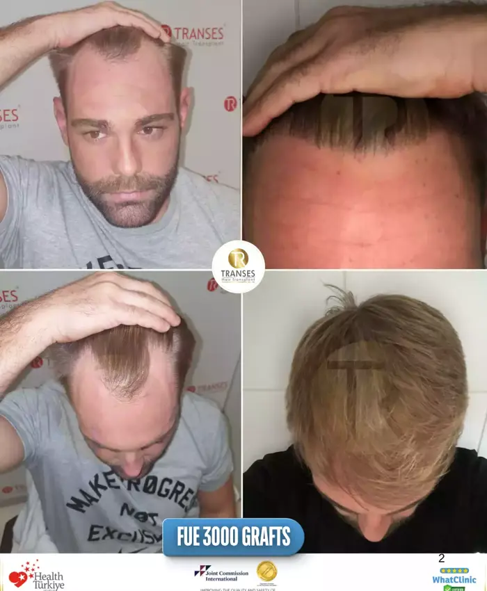 Before & After