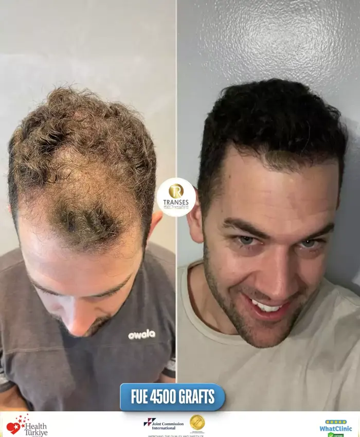 Before & After
